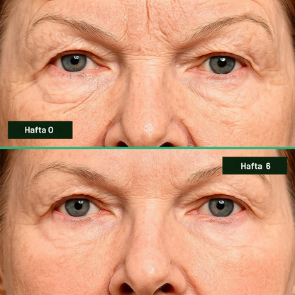 Luméra Kolajen Bant