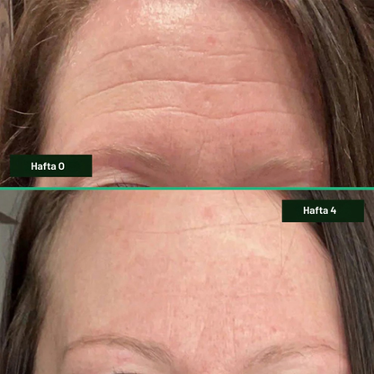 Luméra Kolajen Bant