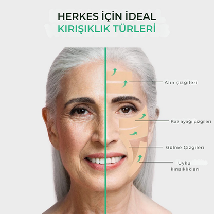 Luméra Kolajen Bant