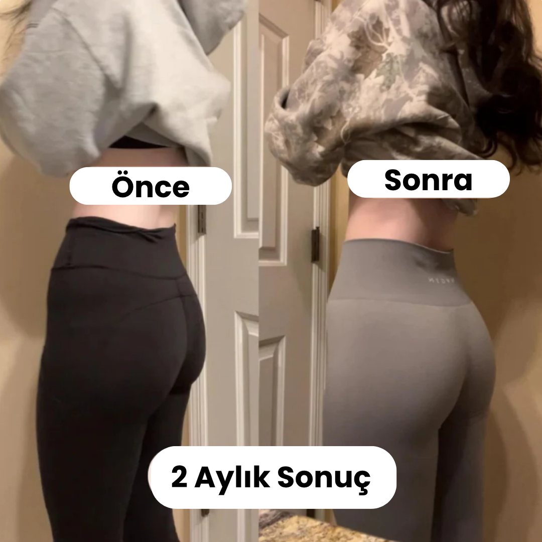 Luméra™ Kalça Şekillendirici & Karın Geliştirici