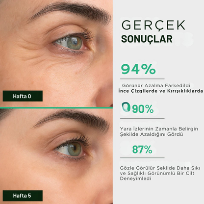 Luméra Kolajen Bant