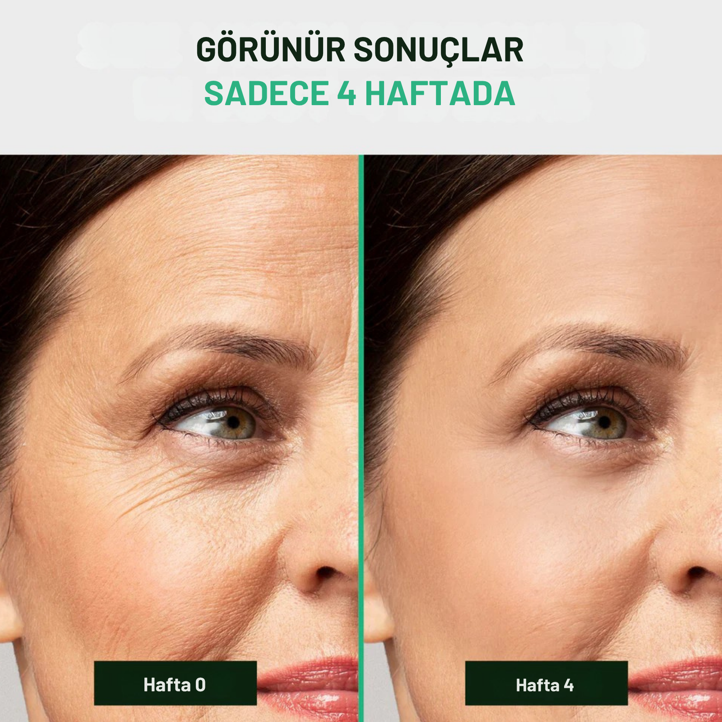 Luméra Kolajen Bant